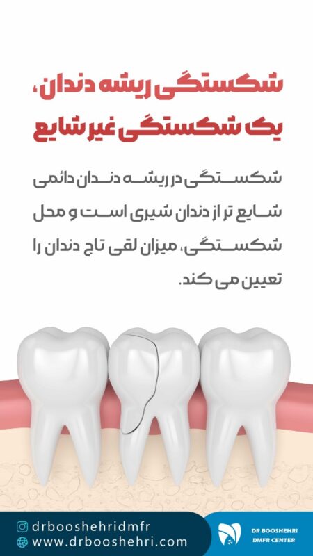 رادیوگرافی دندان: روشی ساده و دقیق برای تشخیص مشکلات دندانی