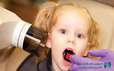 رادیولوژی دندان کودکان ; drbooshehri.com