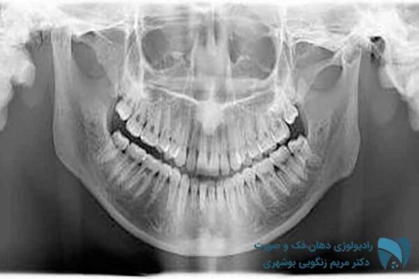 مرکز عکس opg دندان; drbooshehri.com