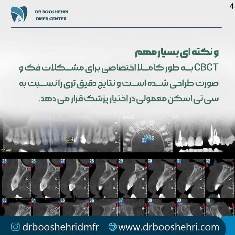 رادیولوژی Cbct در شیراز