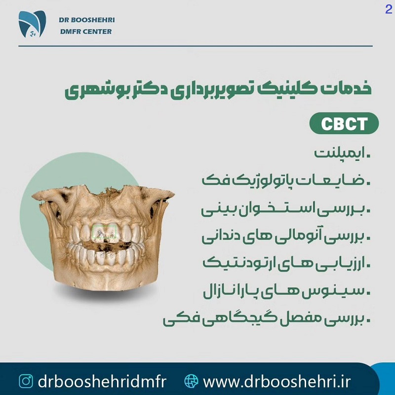 رادیولوژی تخصصی فک و صورت در شیراز