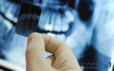 رادیولوژی دندان ; drbooshehri.com