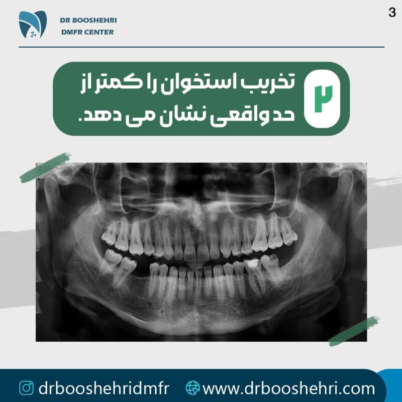 رادیولوژی دندان شناسایی دقیق مشکلات دندانی (2)