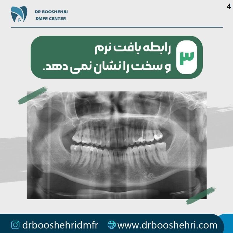 رادیولوژی دندان شناسایی دقیق مشکلات دندانی (3)