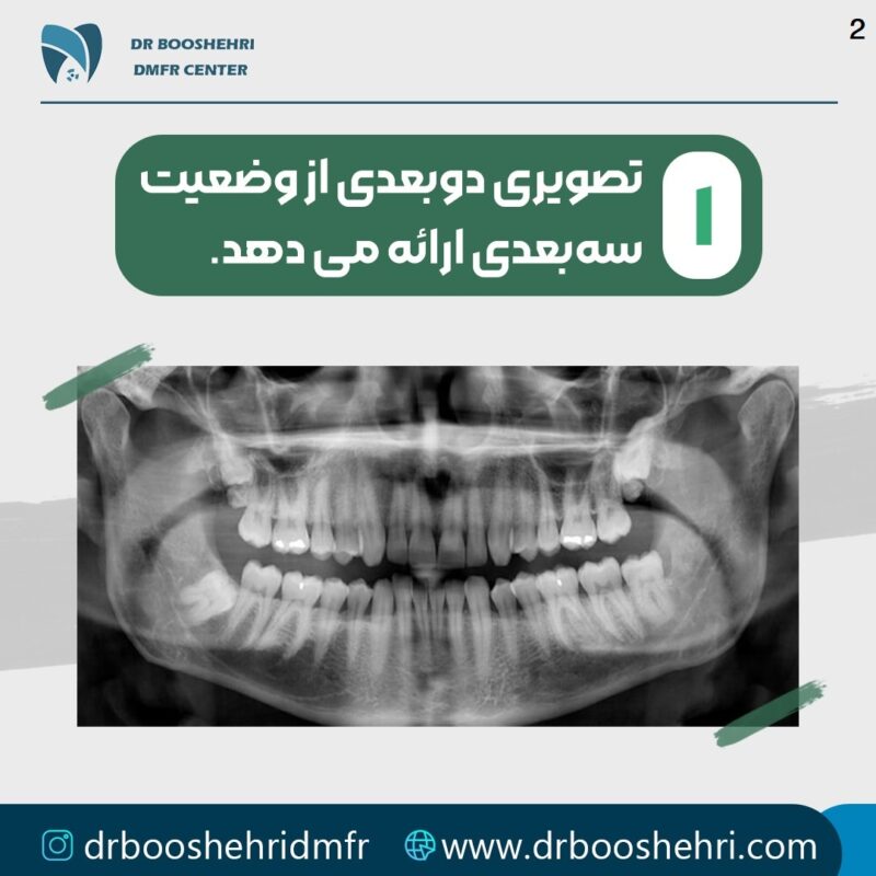رادیولوژی دندان شناسایی دقیق مشکلات دندانی (4)