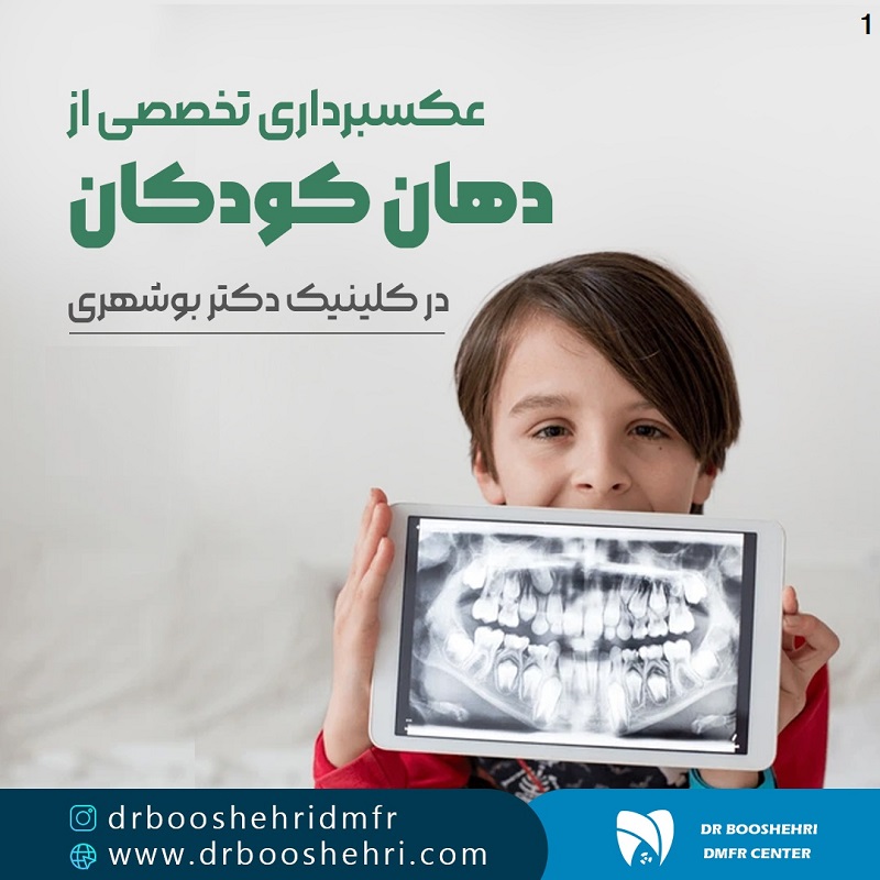 رادیولوژی دندان کودکان در شیراز دارای اتاق مخصوص کودک