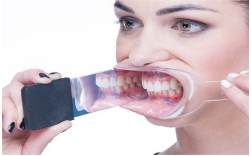 فتوگرافی دندان10