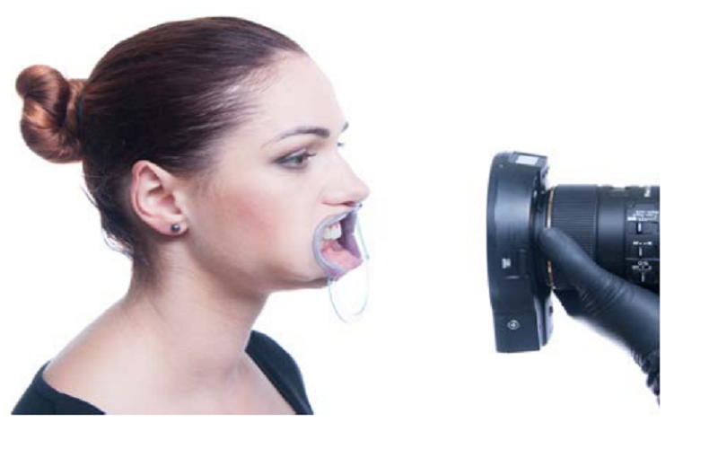 قرارگیری دوربین برای عکاسی داخل دهانی در قسمت جلو