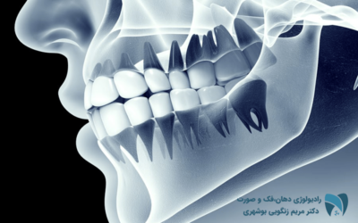 متخصص رادیولوژی دهان و فک و صورت ; drbooshehri.com