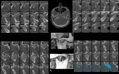 مفصل گیجگاهی فکی; drbooshehri.com