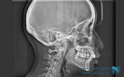 لترال سفالومتری ; drbooshehri.com