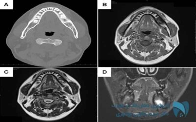 تصویربردای ام آر آی ; drbooshehri.com