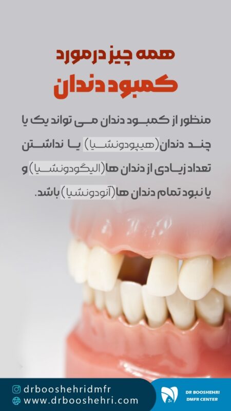 عکسبرداری دندان