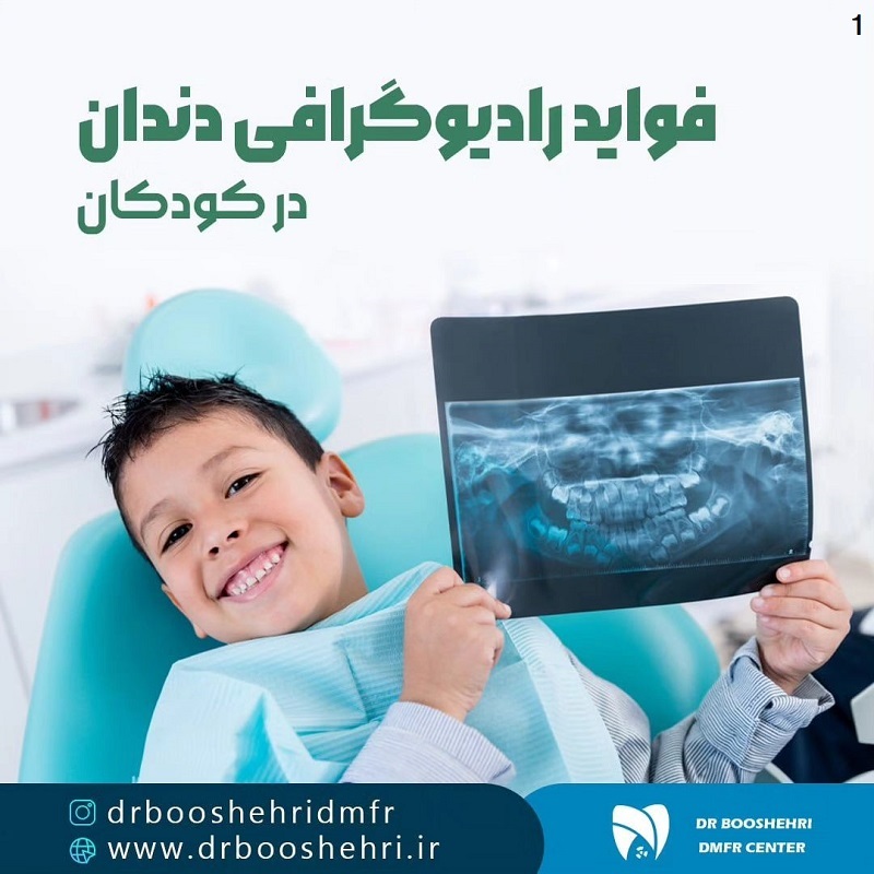 رادیوگرافی دندان کودکان در شیراز دارای اتاق مخصوص کودک