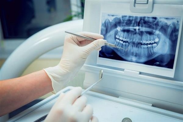 دوزاشعه در رادیوگرافی دهان و دندان