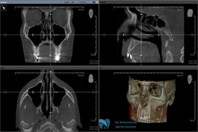 Learn about common mistakes in dental radiology, jaw radiology, and oral imaging, and discover how to improve accuracy in maxillofacial imaging.
