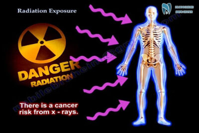 Learn about Radiology Risks, how X-ray Radiation affects health, and discover effective ways to minimize Imaging Side Effects during medical