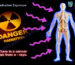 Learn about Radiology Risks, how X-ray Radiation affects health, and discover effective ways to minimize Imaging Side Effects during medical