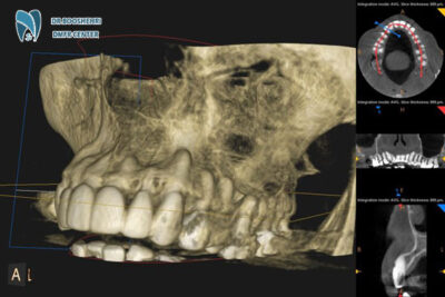 CBCT imaging is an advanced imaging technology providing detailed 3D scans, widely used in dentistry and oral & maxillofacial radiology.