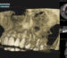 CBCT imaging is an advanced imaging technology providing detailed 3D scans, widely used in dentistry and oral & maxillofacial radiology.