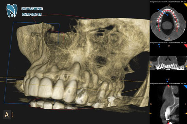 CBCT imaging is an advanced imaging technology providing detailed 3D scans, widely used in dentistry and oral & maxillofacial radiology.