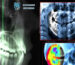 Cephalometric imaging is a vital technique in maxillofacial radiography. Discover the applications of cephalometry in diagnosing abnormalities