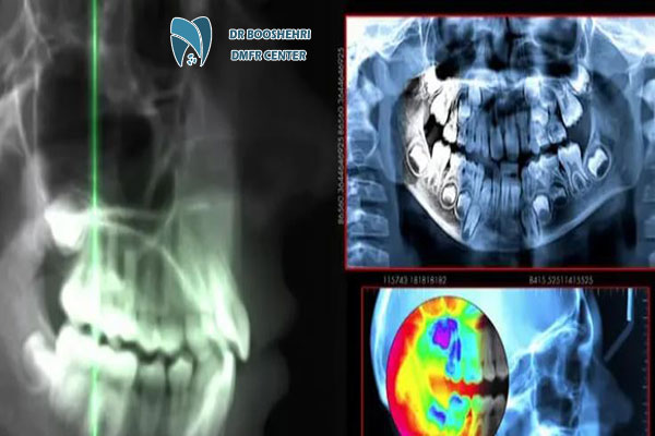 Cephalometric imaging is a vital technique in maxillofacial radiography. Discover the applications of cephalometry in diagnosing abnormalities