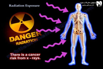 خطرات رادیولوژی چیست؟ با بررسی تاثیرات اشعه رادیولوژی، ضررهای تصویربرداری، و روشهای کاهش خطرات این اشعه آشنا شوید.