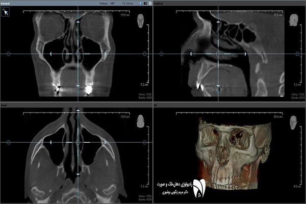 اشتباهات رایج در رادیولوژی فک و صورت می‌تواند بر کیفیت تشخیص تأثیر بگذارد. نکات کلیدی تصویربرداری دهان و دندان و تصویربرداری دندان و فک را بدانید.