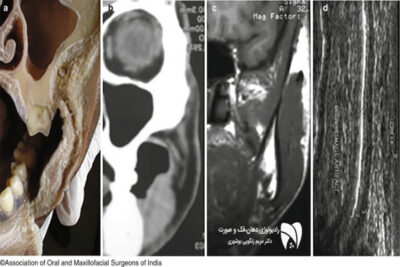 تحول تصویربرداری دندان از اشعه ایکس تا دیجیتال. بررسی تاریخچه رادیولوژی دهان و فک و پیشرفت فناوری رادیولوژی فک و صورت.