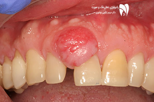 پاتولوژی دهان چیست؟ با تشخیص زودهنگام بیماری‌های دهان و فک و استفاده از رادیولوژی پیشرفته، از سلامت دهان و فک خود محافظت کنید.