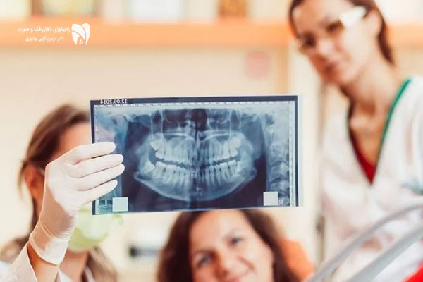 رادیولوژی دندان برای تشخیص مشکلات دهان و دندان ضروری است. اهمیت تصویربرداری دهان و دندان و مزایای آن را در این مطلب بخوانید.