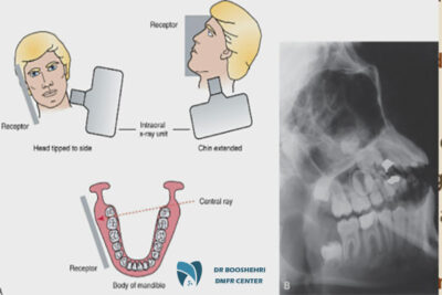 This article explores extraoral imaging for special patients and the importance of oral radiology for better treatment outcomes.