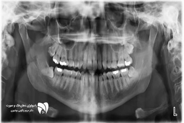 مقایسه تصویربرداری داخل دهانی و تصویربرداری خارج دهانی: کدام بهتر است؟ بخوانید درباره مزایا و معایب هر کدام و انتخاب روش مناسب برای شما.