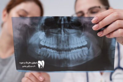 با کاربرد تصویربرداری فک و صورت در تشخیص صدمات فک و صورت آشنا شوید. 5 مزیت استفاده از روشهای پیشرفته رادیولوژی دهان و صورت را کشف کنید.