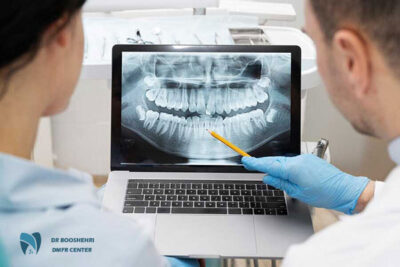 Intraoral radiography is a precise dental imaging tool for dental diagnosis, detecting decay, infections, and aiding in jaw and dental treatments.