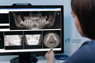 Is oral radiology X-ray really harmful? This article explores the effects of dental radiology on health and examines dental imaging risks.