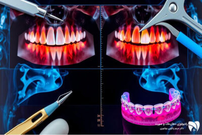 نقش رادیوگرافی در ارتودنسی دندان
